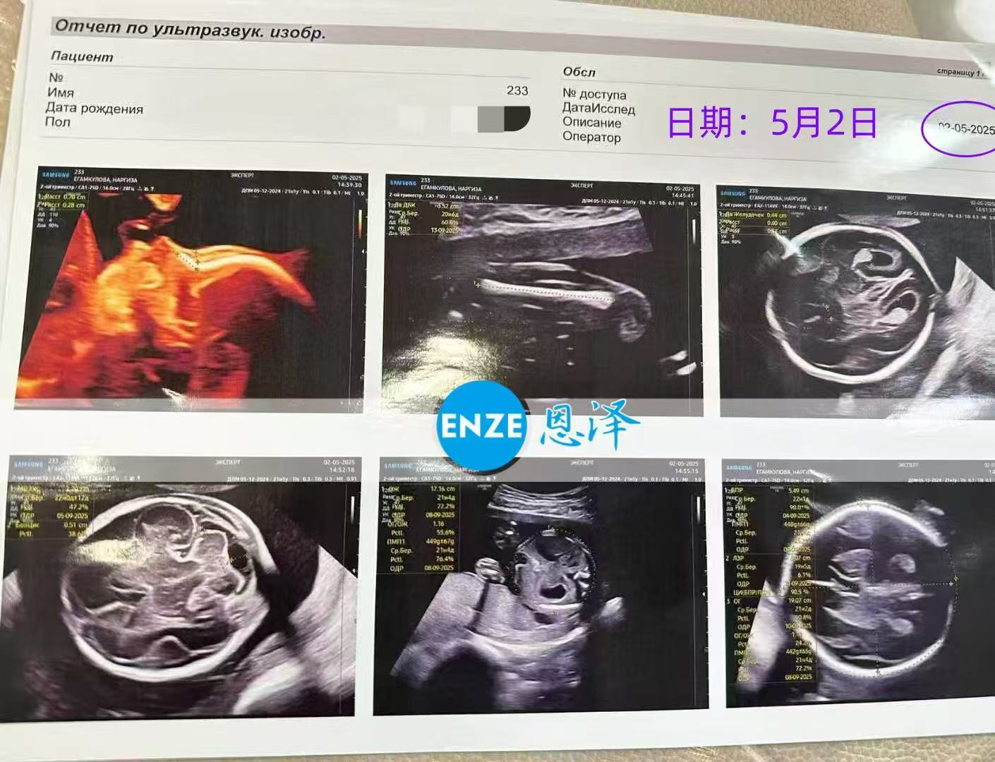 格鲁吉亚代孕代孕代母21周产检顺利通过