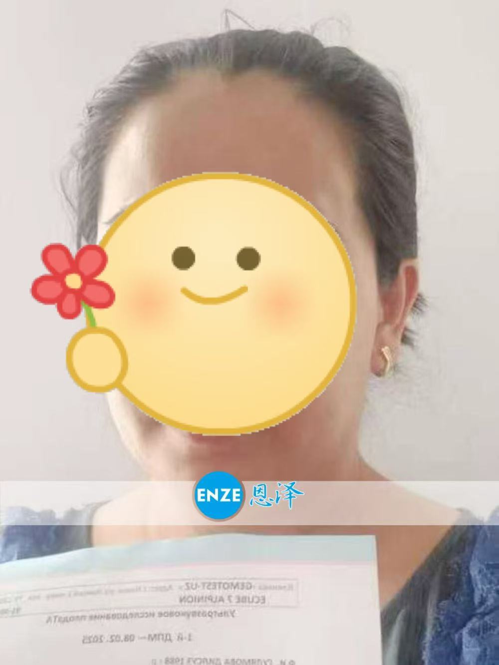 格鲁吉亚代孕代孕代母12周产检顺利通过