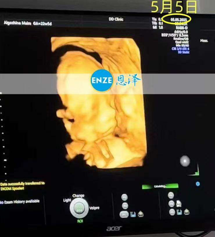 格鲁吉亚代孕代孕代母22周产检顺利通过