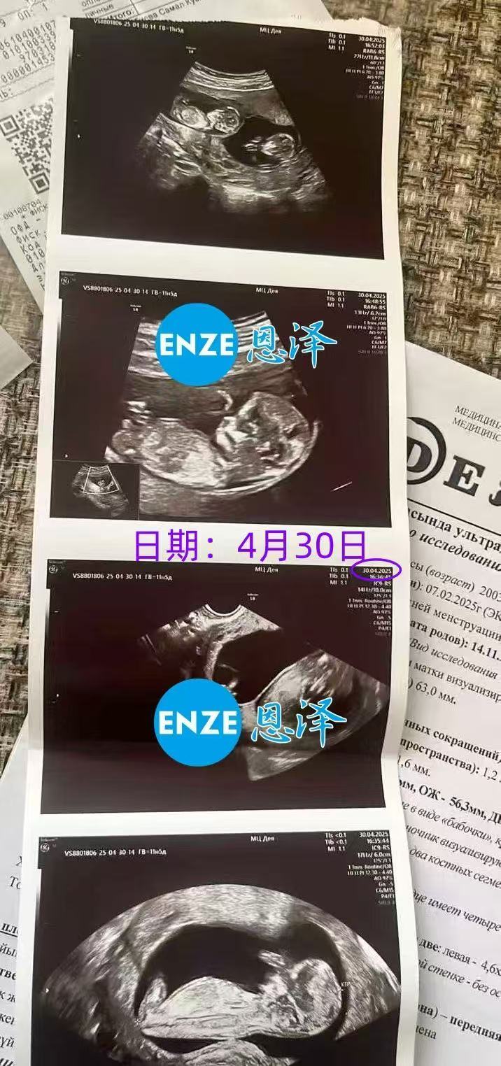 格鲁吉亚代孕代孕代母12周产检顺利通过
