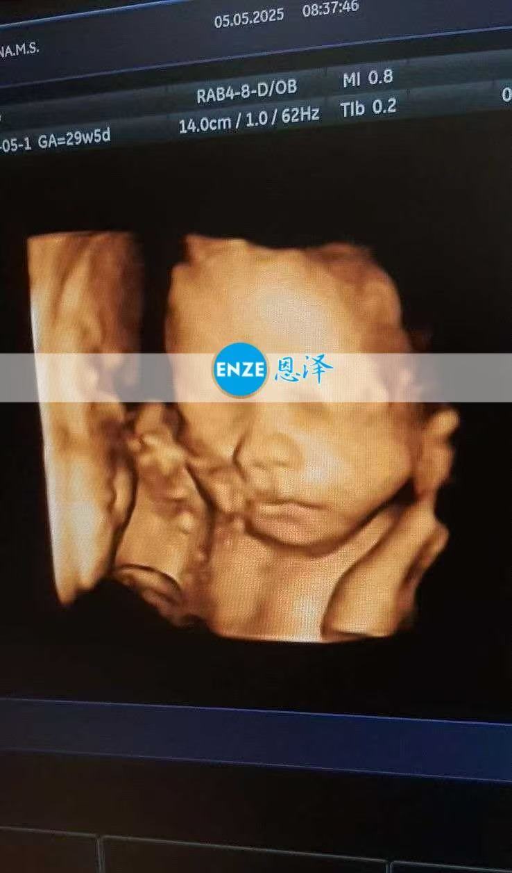 乌克兰代孕代孕代母28周检查顺利过关