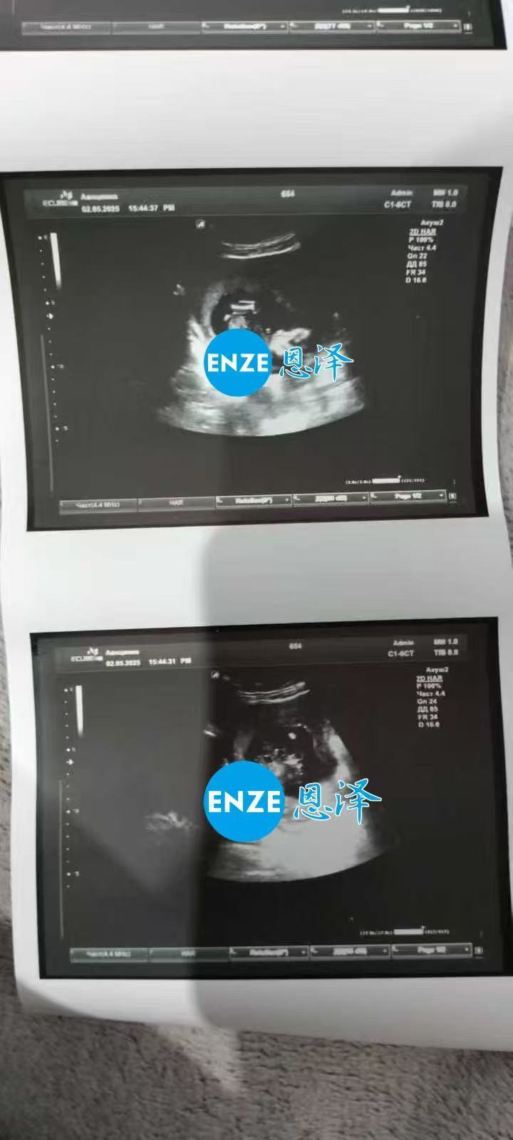 格鲁吉亚代孕代孕代母16周产检顺利通过