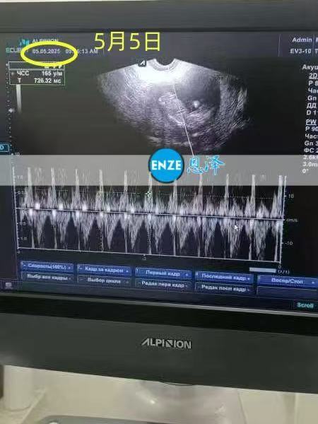格鲁吉亚代孕代孕代母12周产检顺利通过