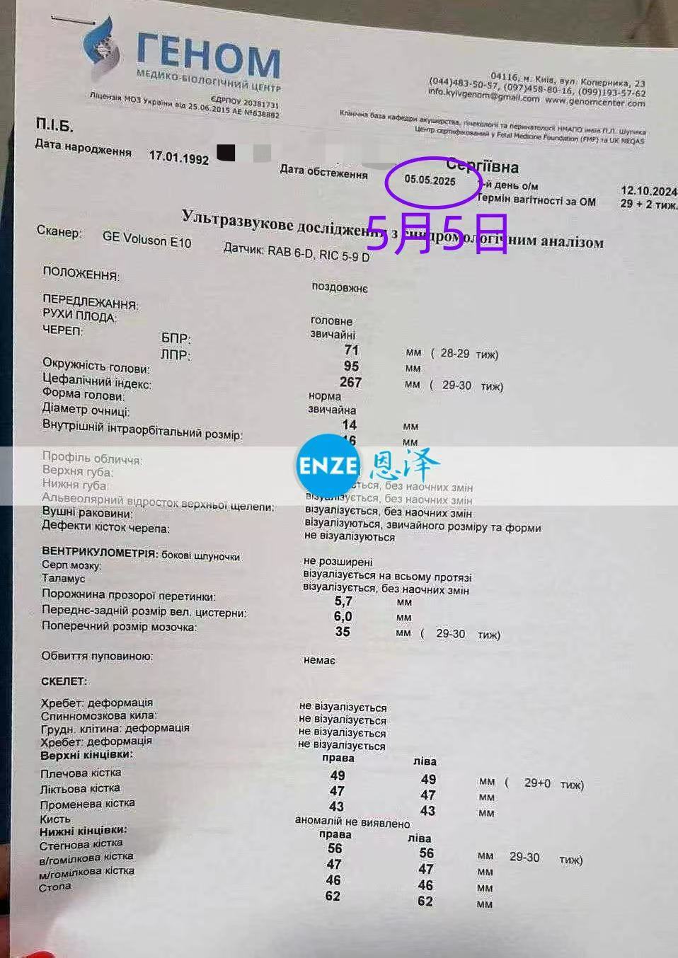 乌克兰代孕代孕代母28周检查顺利过关