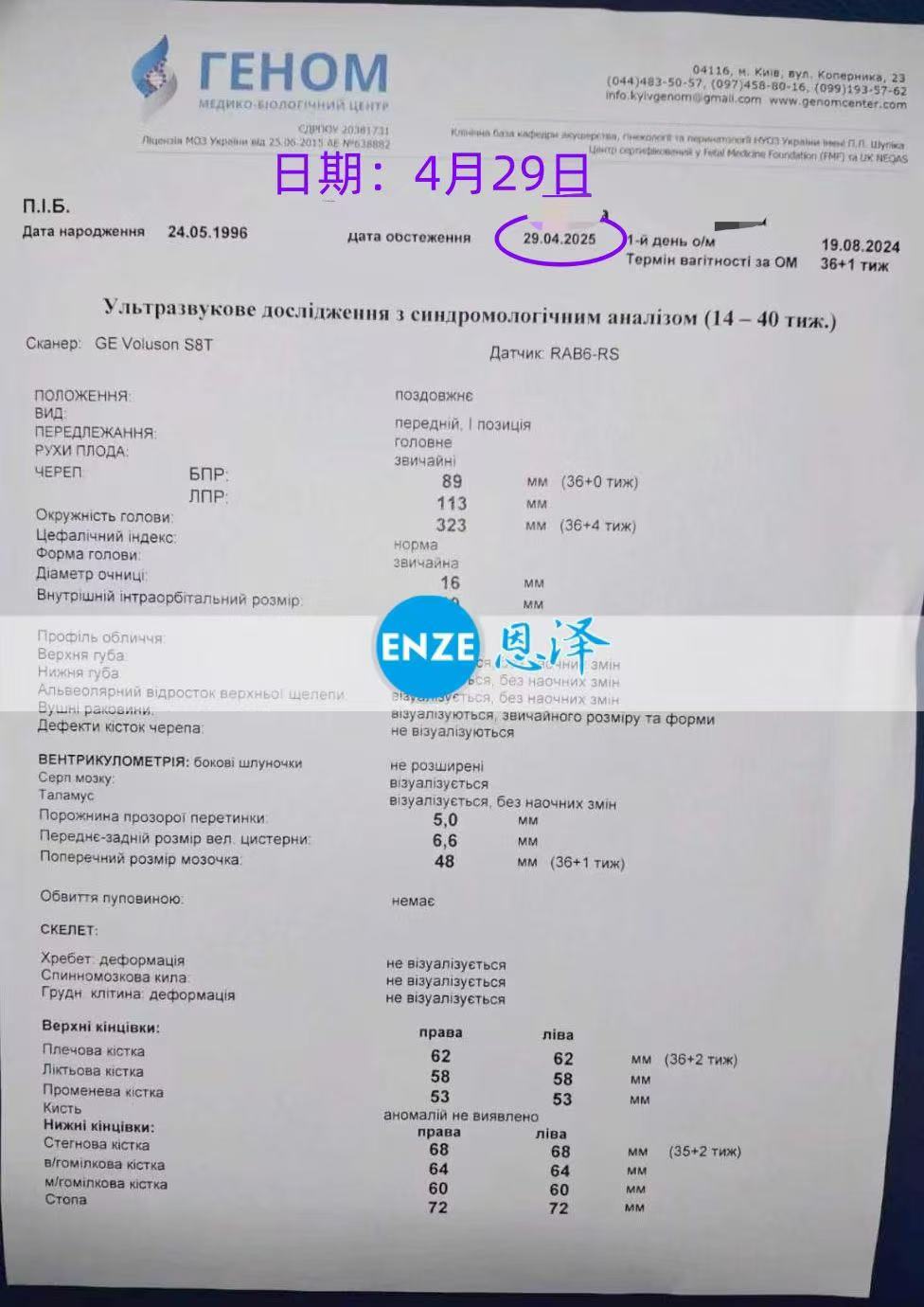 乌克兰代孕代孕代母产检顺利，静待宝贝降生
