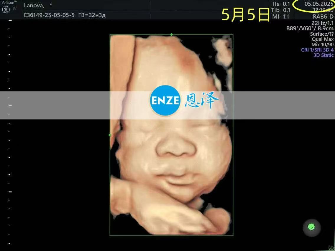 格鲁吉亚代孕代孕代母32周产检顺利通过