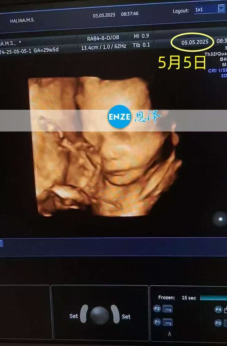 乌克兰代孕代孕代母28周检查顺利过关