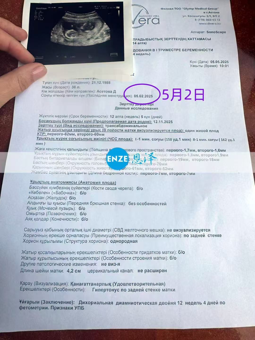 格鲁吉亚代孕代孕代母正式度过风险期