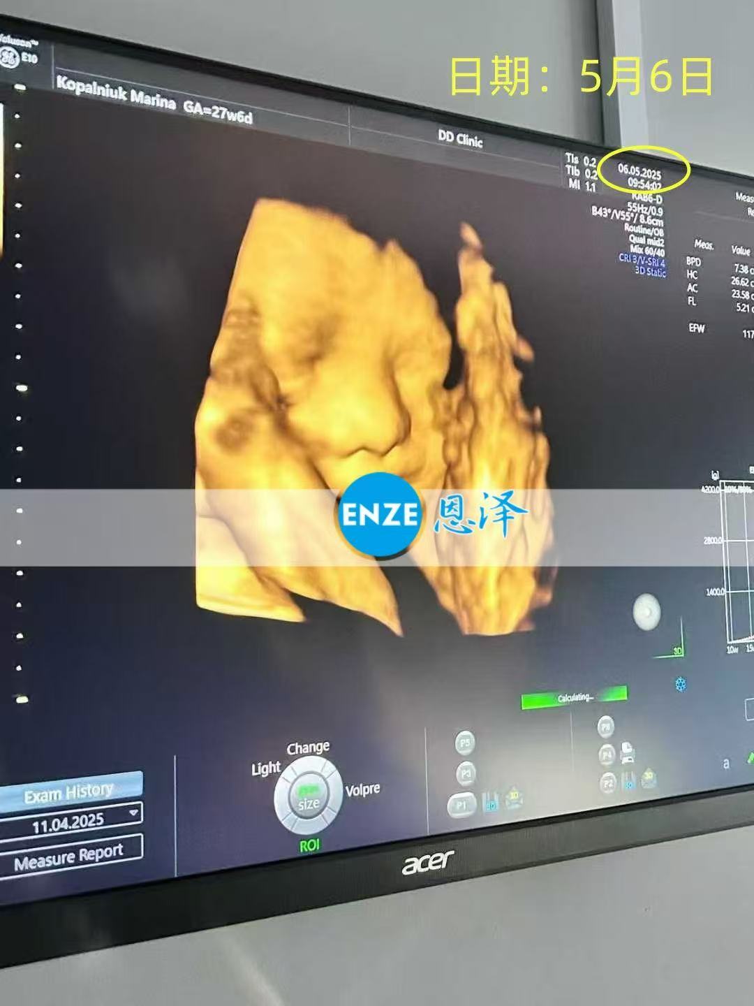 格鲁吉亚代孕代孕代母27周产检顺利通过