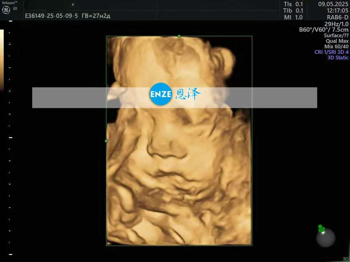 乌克兰代孕代孕代母27周产检顺利通过