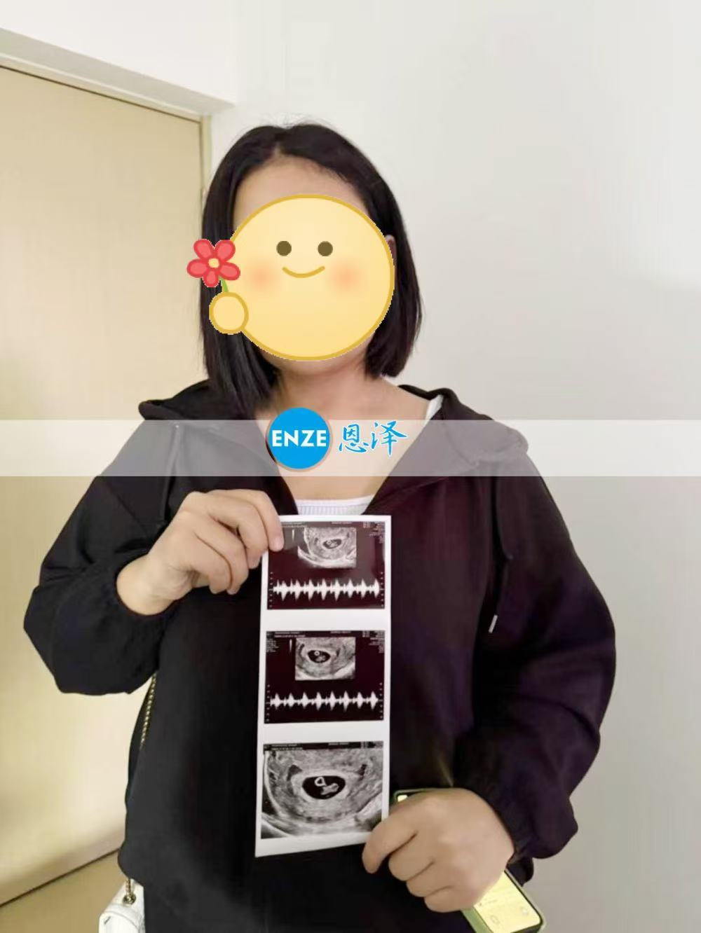 格鲁吉亚代孕代孕代母成功通过7周产检