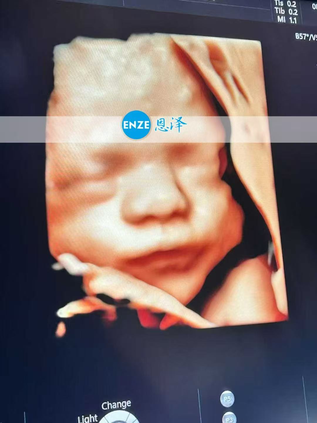 格鲁吉亚代孕代孕代母29周产检顺利通过