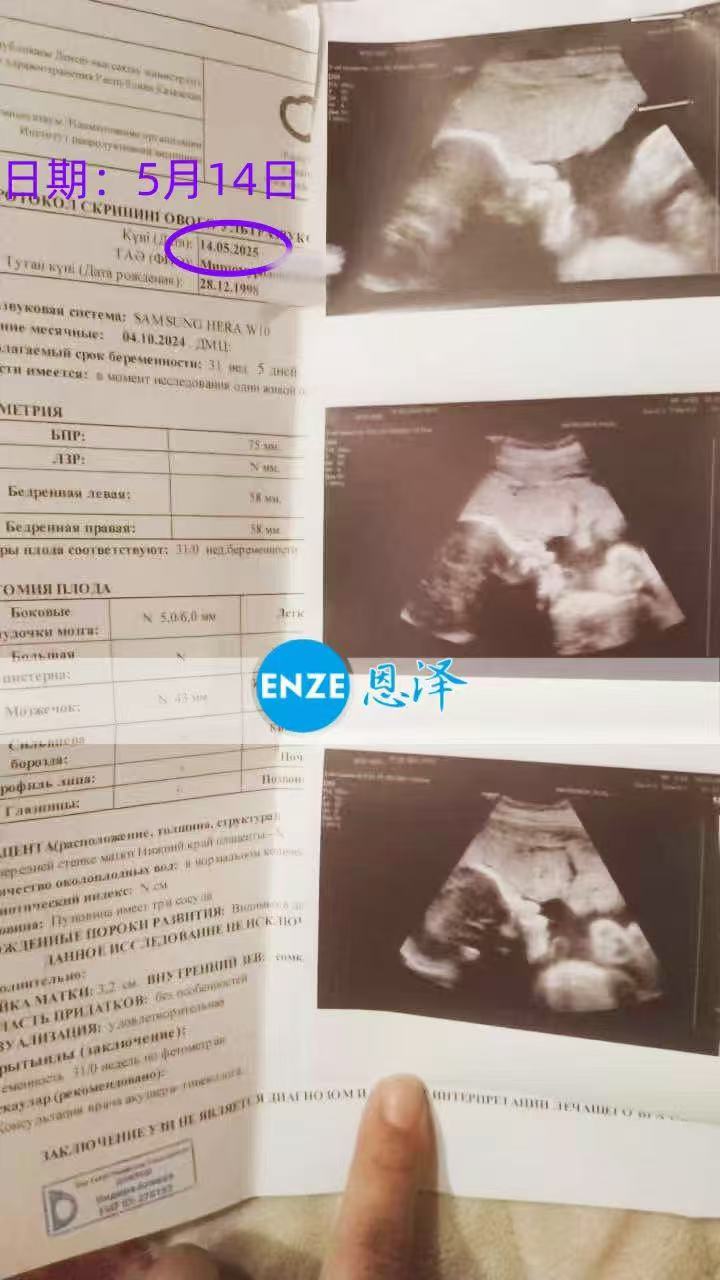 哈萨克斯坦代孕代孕代母31周产检顺利通过