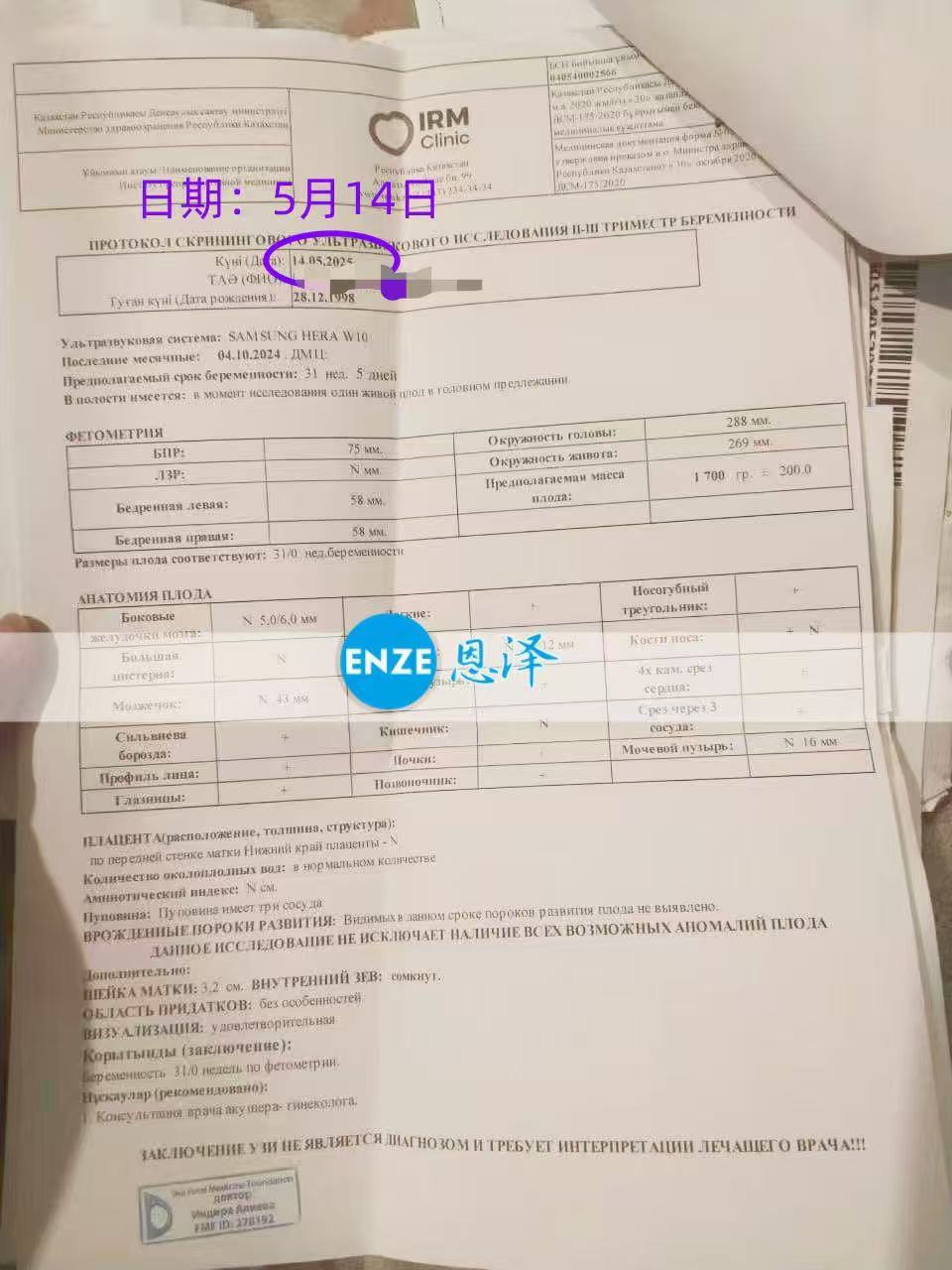 哈萨克斯坦代孕代孕代母31周产检顺利通过