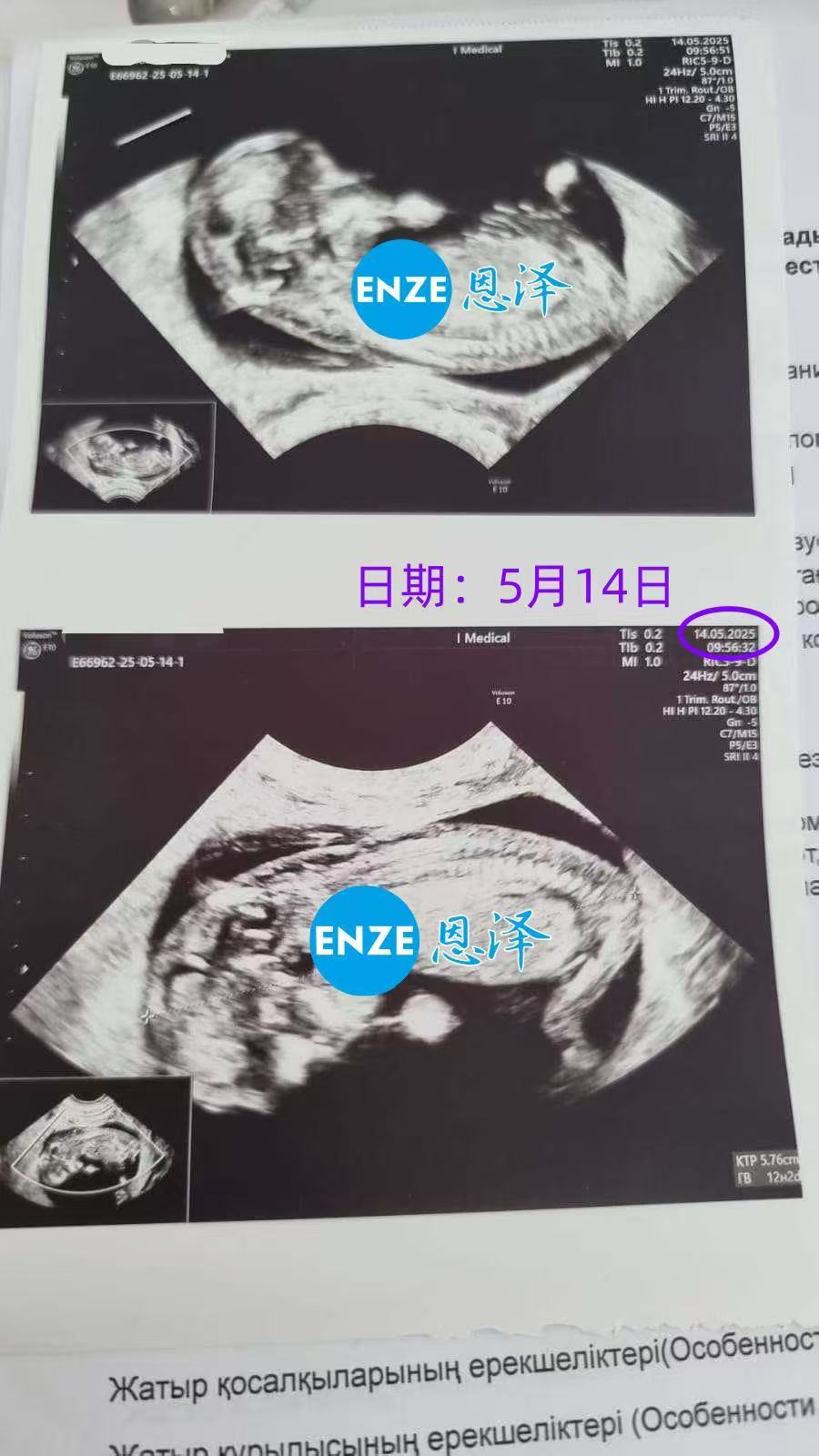 格鲁吉亚代孕代孕代母正式进入稳定期