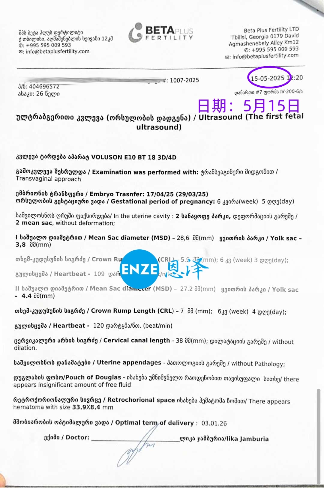 恩泽格鲁吉亚代孕代母6周检查顺利通过