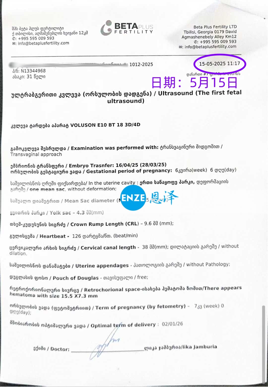 恩泽格鲁吉亚代孕代母7周检查顺利通过