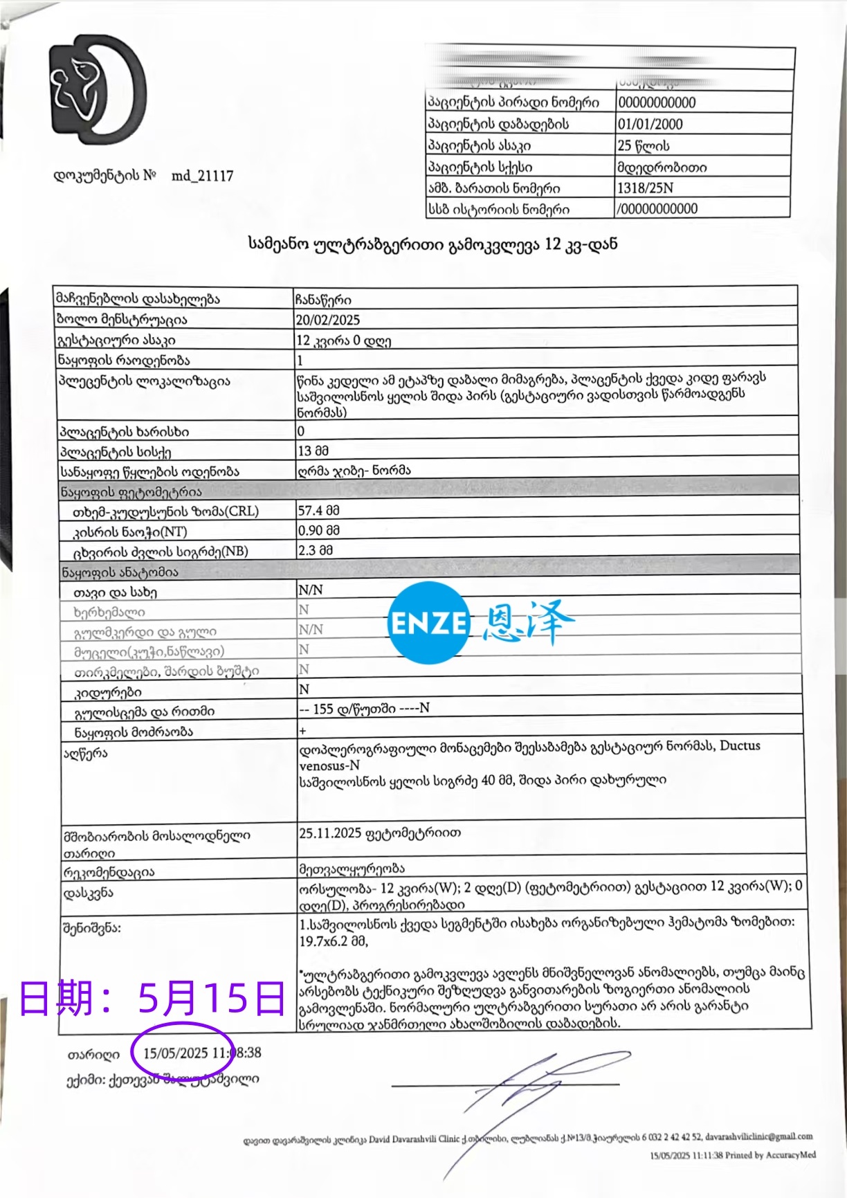 恩泽格鲁吉亚代孕代母12周检查顺利通过