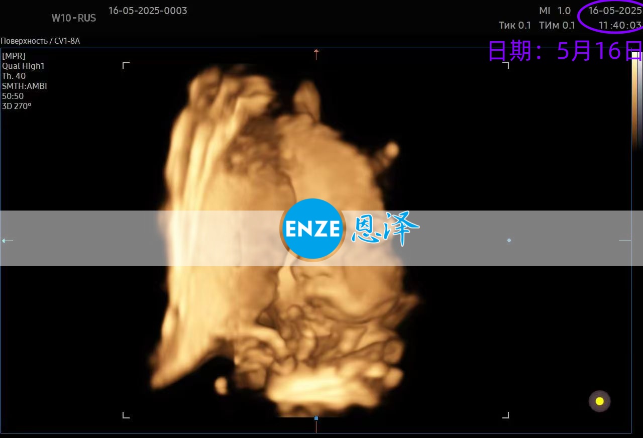恩泽格鲁吉亚代孕代母32周检查顺利通过