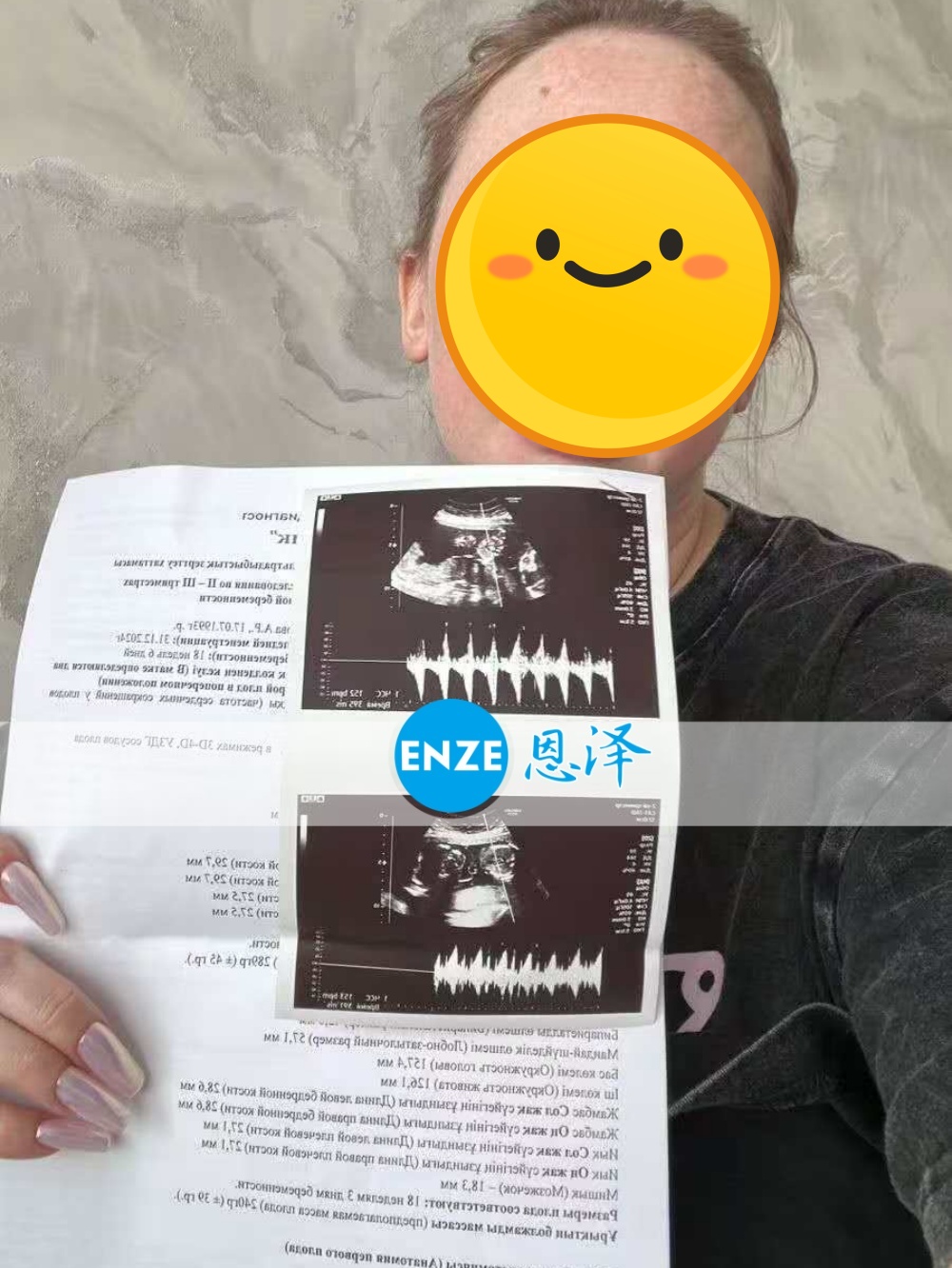 恩泽格鲁吉亚代孕代母18周检查顺利通过