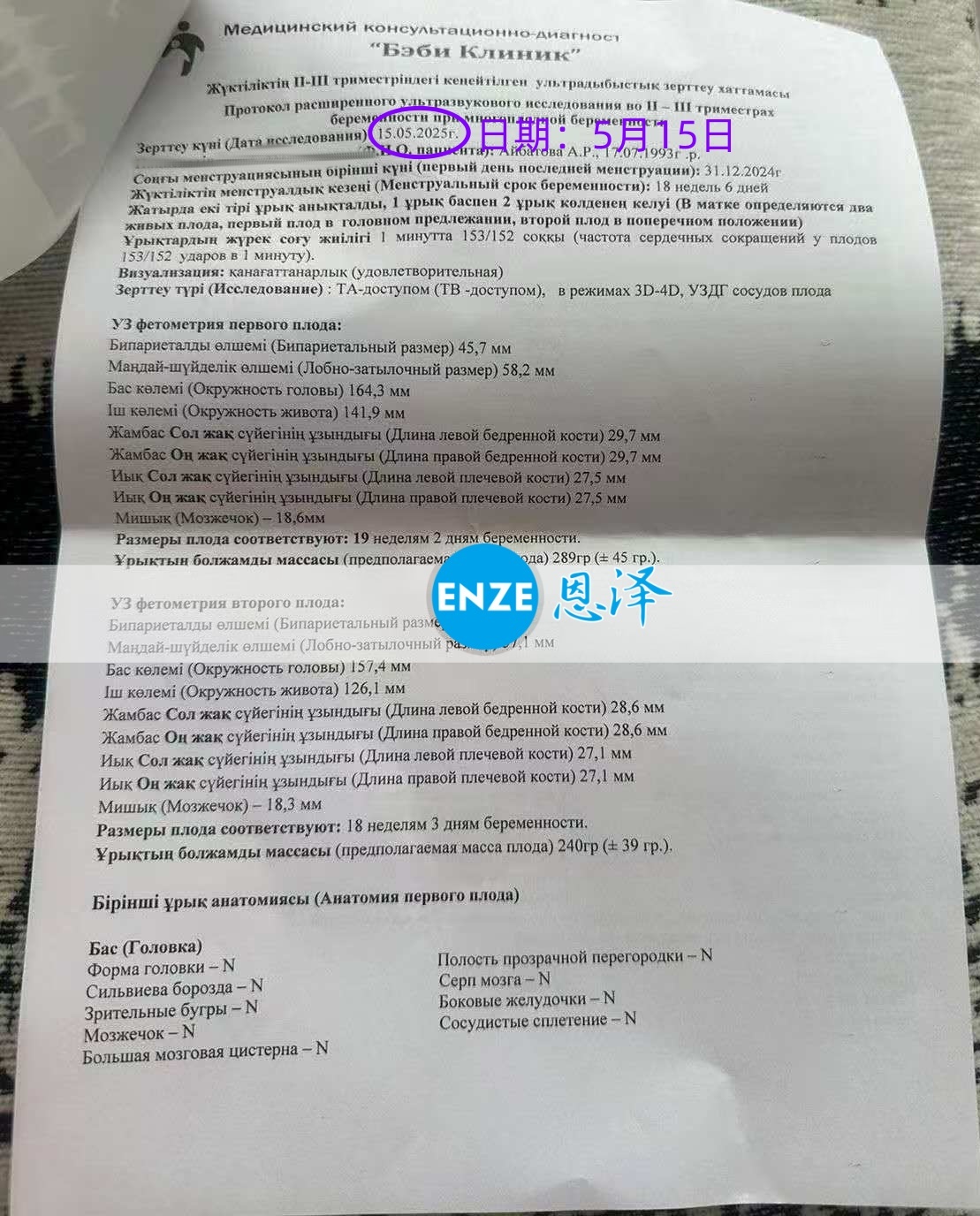 恩泽格鲁吉亚代孕代母18周检查顺利通过