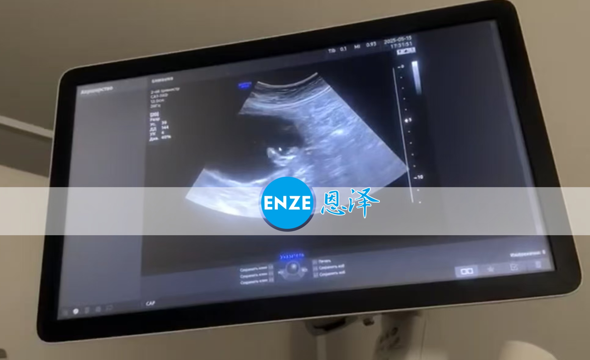 恩泽格鲁吉亚代孕代母18周检查顺利通过
