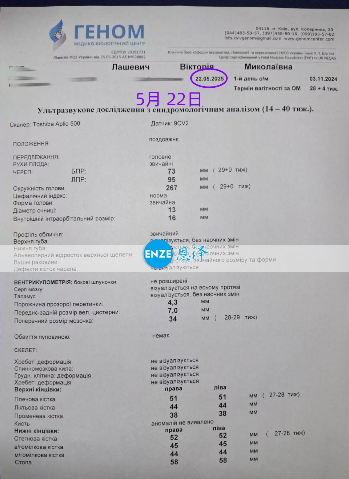恩泽乌克兰代孕代母28周产检顺利通过