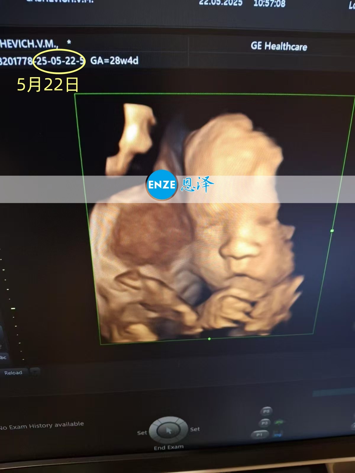 恩泽乌克兰代孕代母28周产检顺利通过