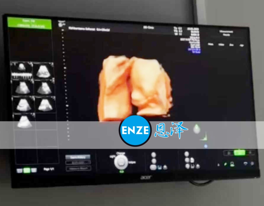 恩泽格鲁吉亚代孕代母26周检查顺利通过