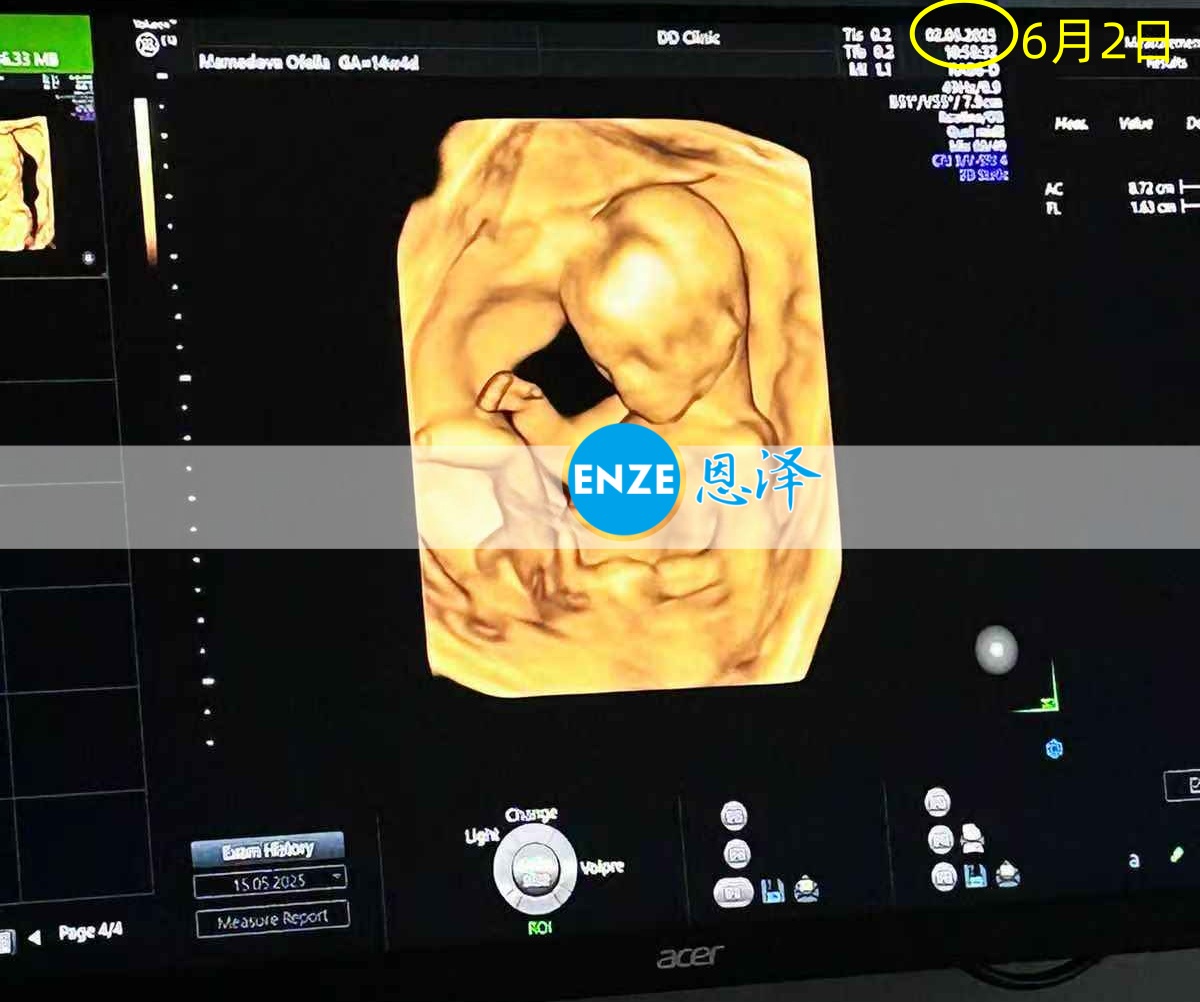 恩泽格鲁吉亚代孕代母14周检查顺利通过