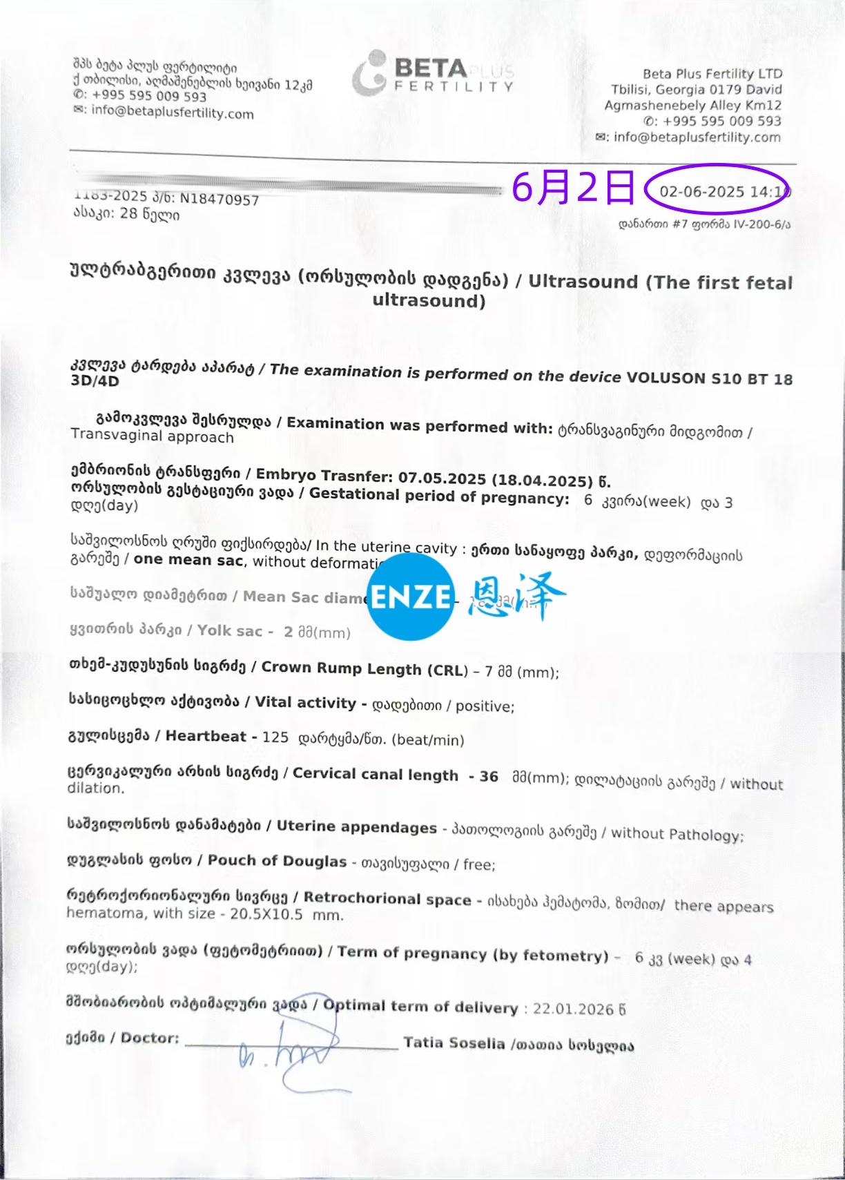 恩泽格鲁吉亚代孕代母6周检查顺利通过