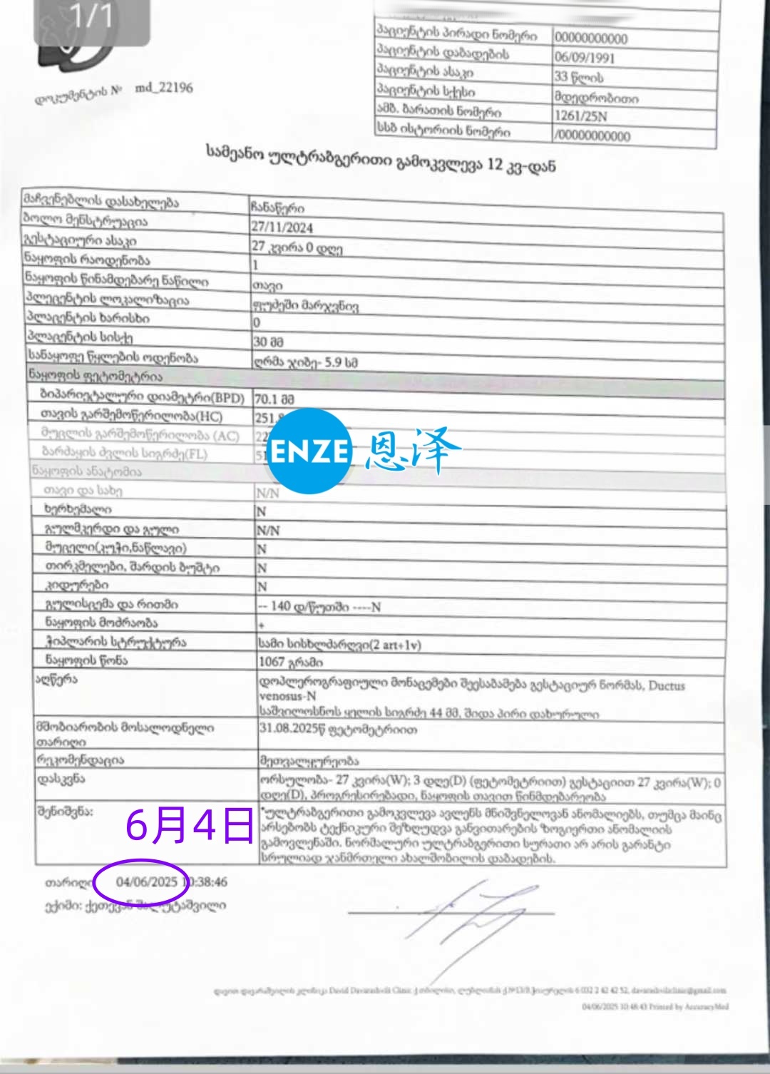 恩泽格鲁吉亚代孕代母27周检查顺利通过
