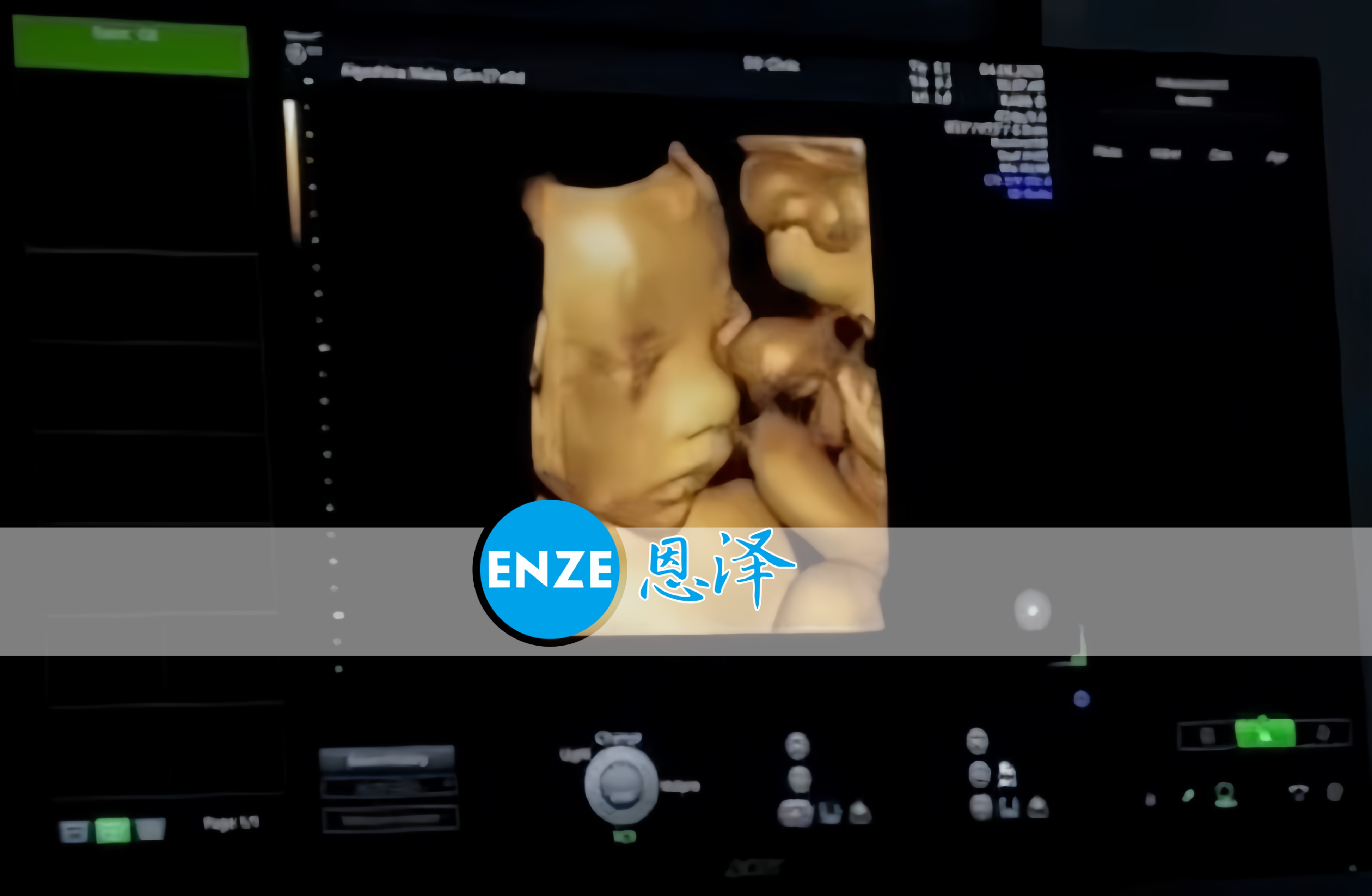 恩泽格鲁吉亚代孕代母27周检查顺利通过