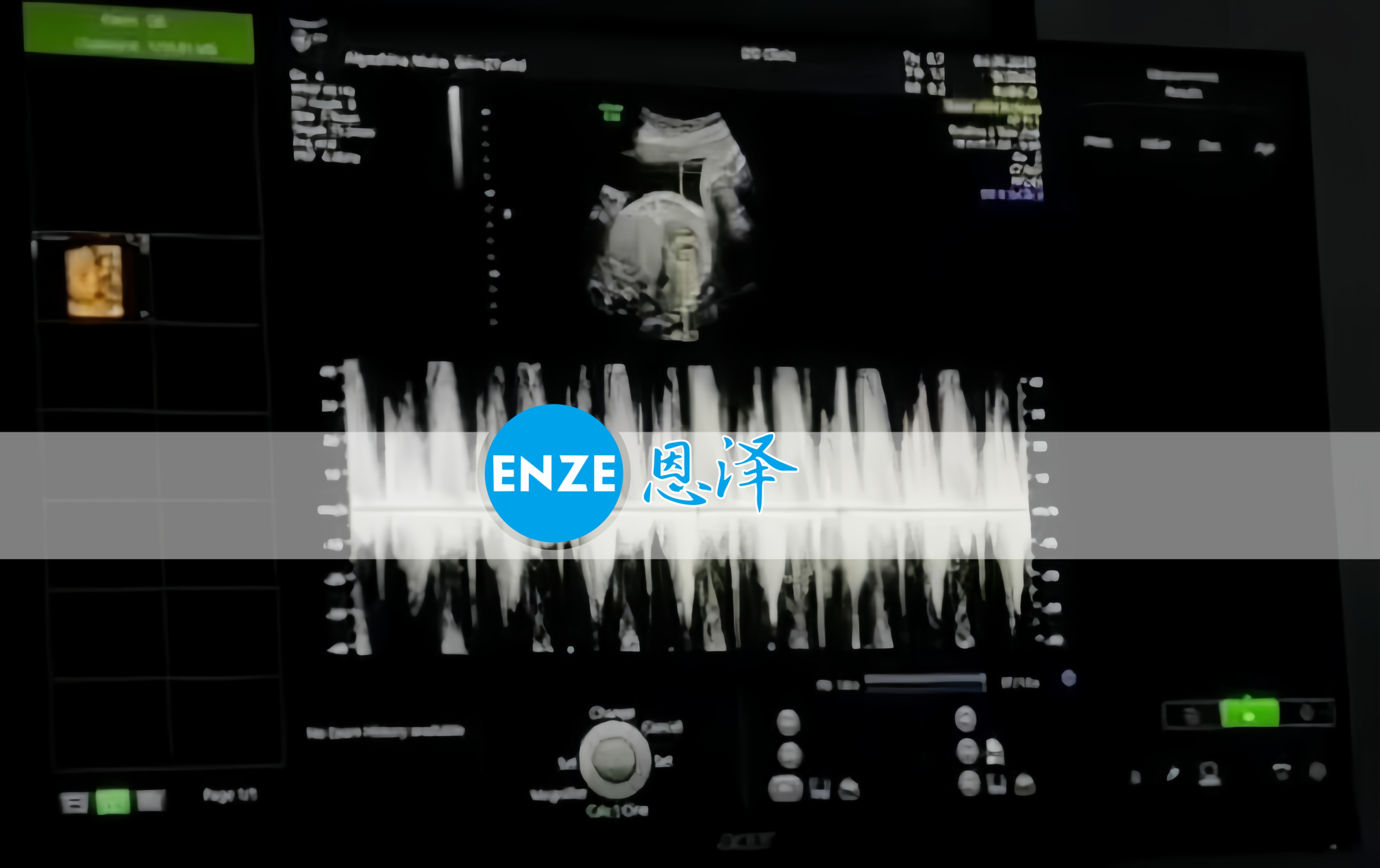 恩泽格鲁吉亚代孕代母27周检查顺利通过