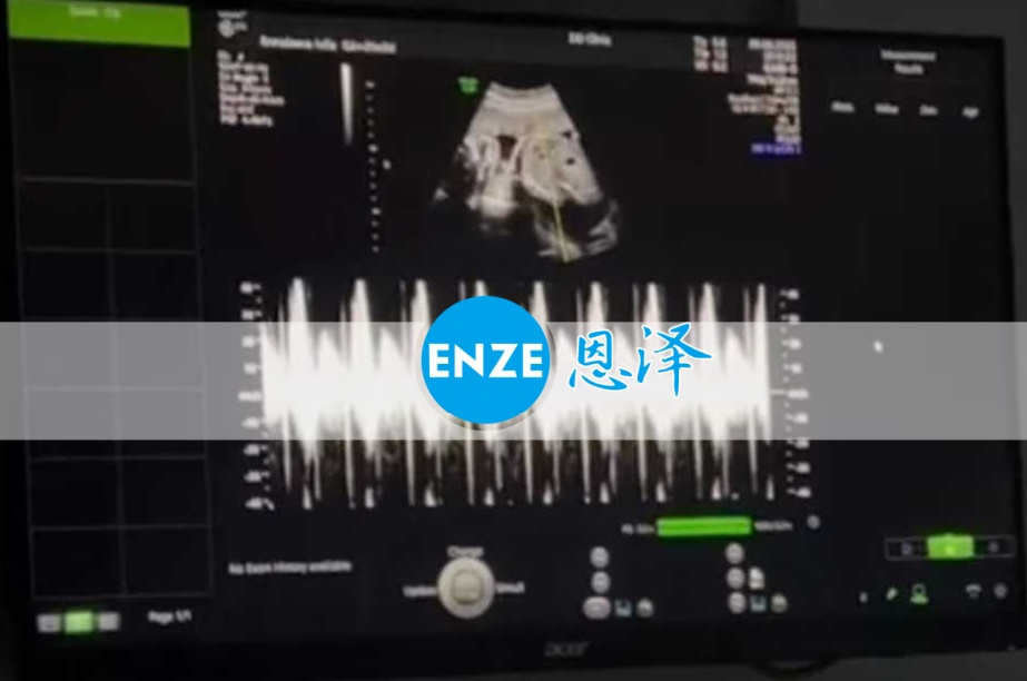 恩泽格鲁吉亚代孕代母21周检查顺利通过