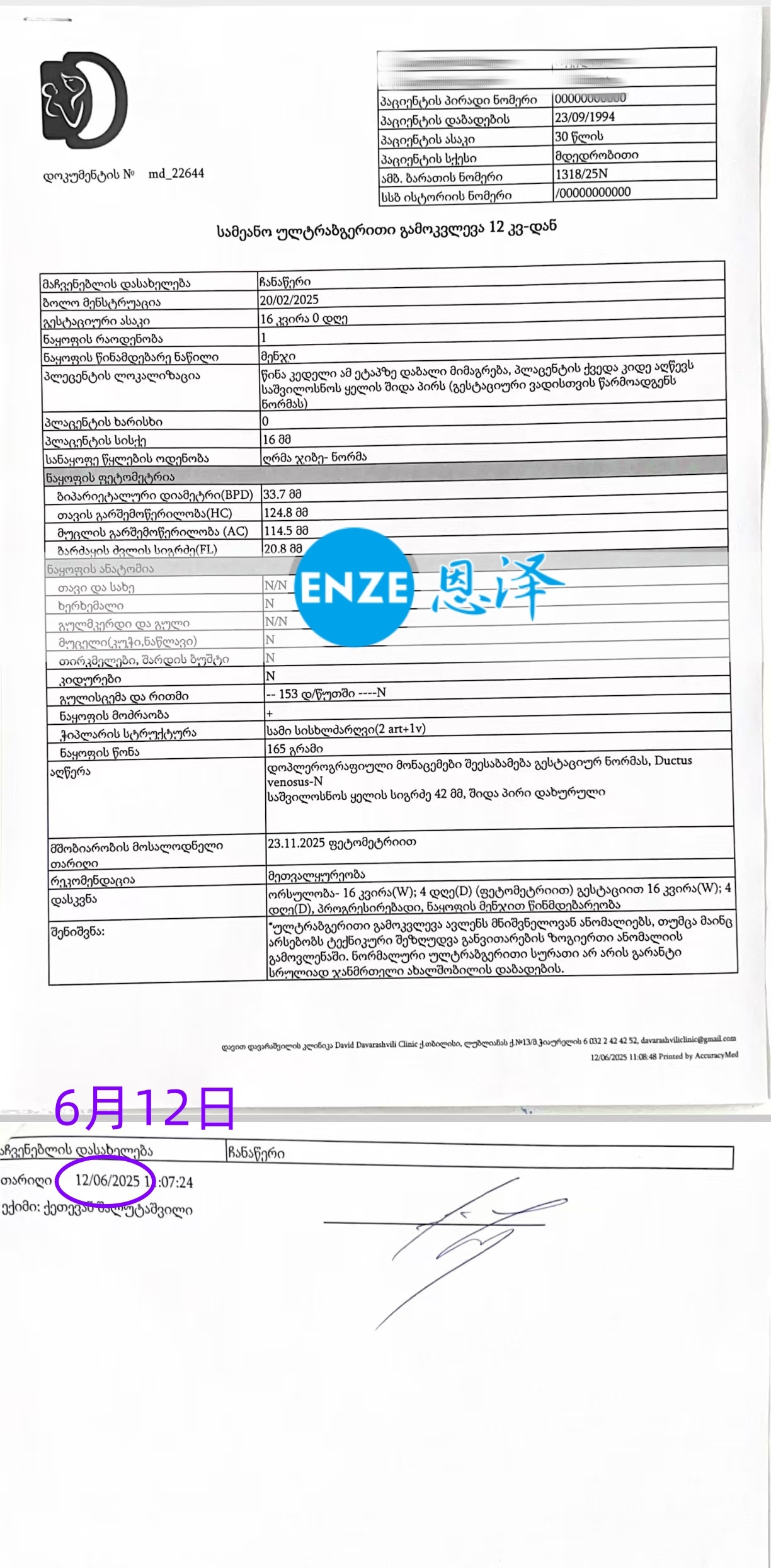 恩泽格鲁吉亚代孕代母16周检查顺利通过