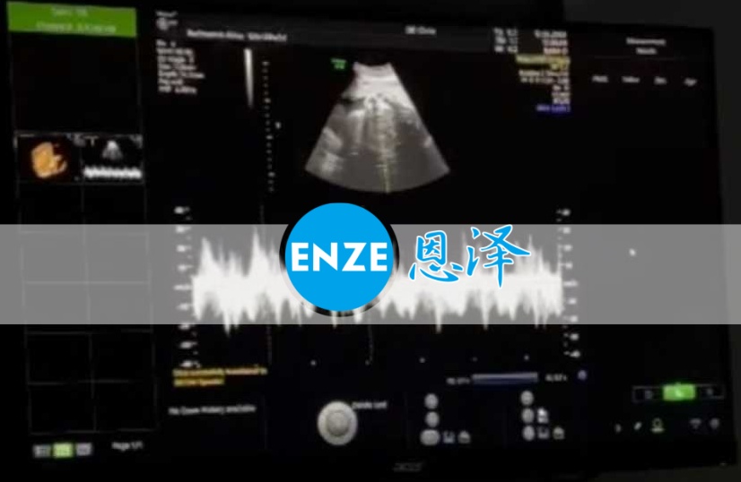 恩泽格鲁吉亚代孕代母29周检查顺利通过