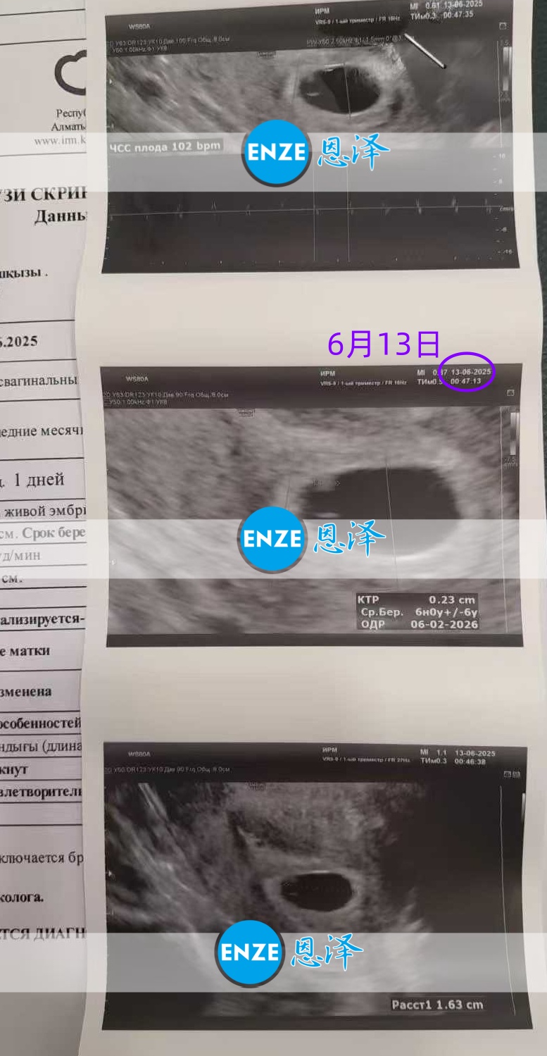 恩泽格鲁吉亚代孕代母6周检查顺利通过
