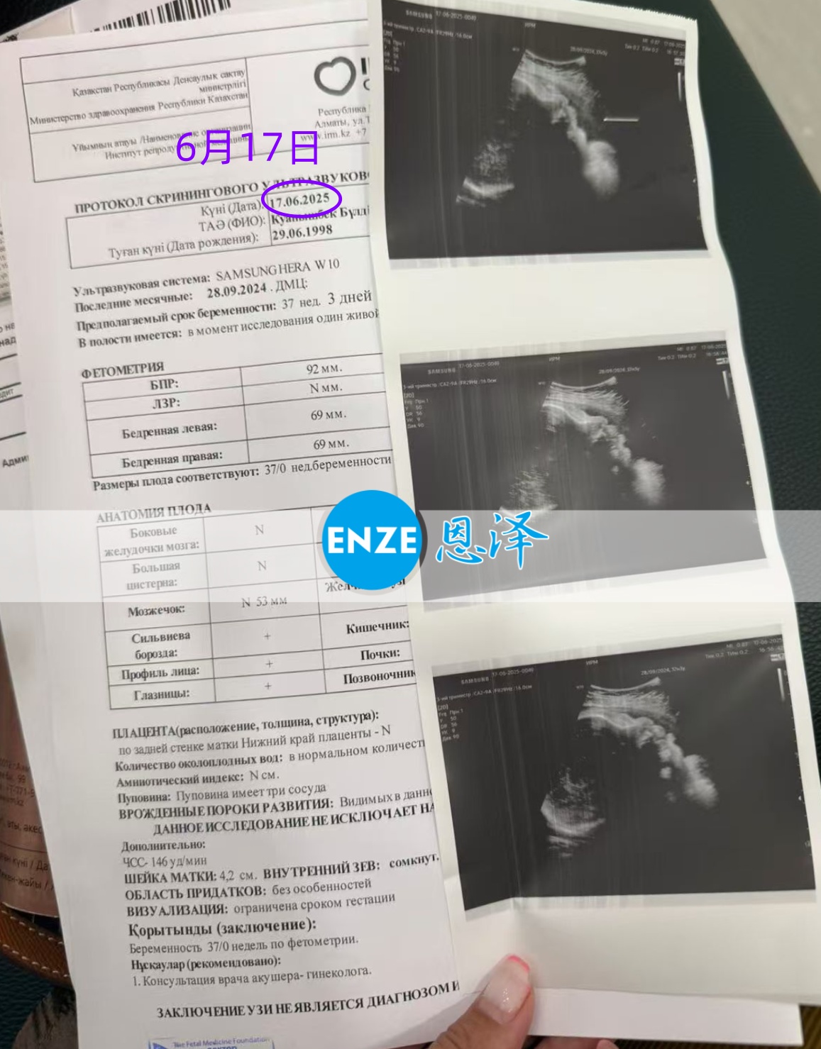 恩泽格鲁吉亚代孕代母37周检查顺利通过