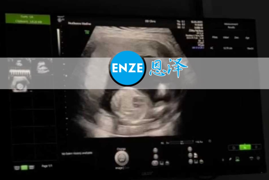 恩泽格鲁吉亚代孕代母17周检查顺利通过