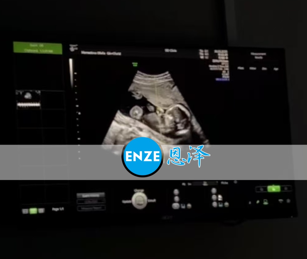 恩泽格鲁吉亚代孕代母17周检查顺利通过