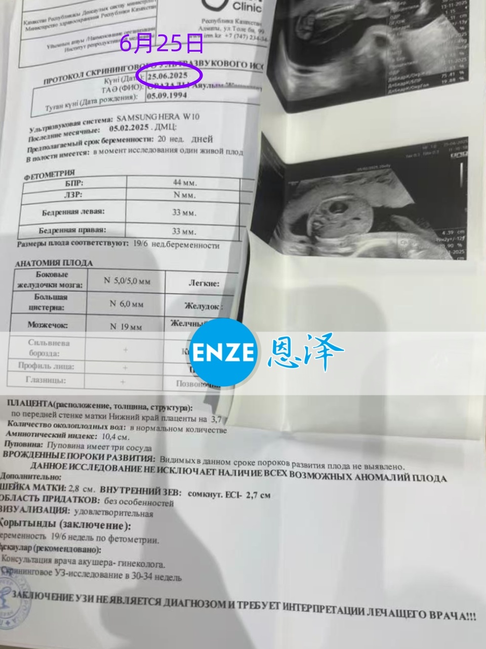 恩泽哈萨克斯坦代孕代母20周检查顺利通过