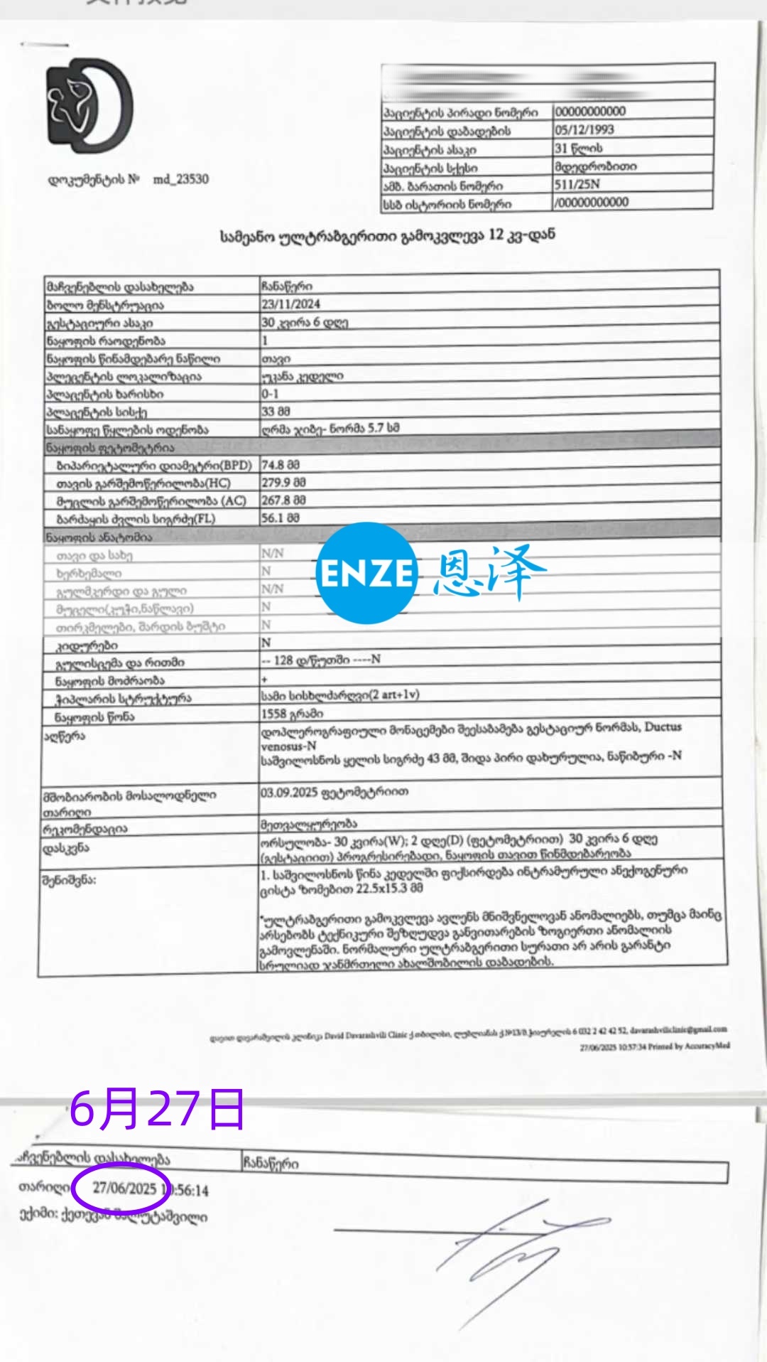 恩泽格鲁吉亚代孕代母30周检查顺利通过