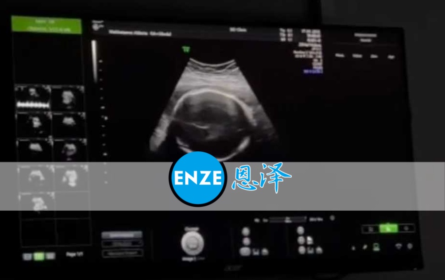 恩泽格鲁吉亚代孕代母30周检查顺利通过