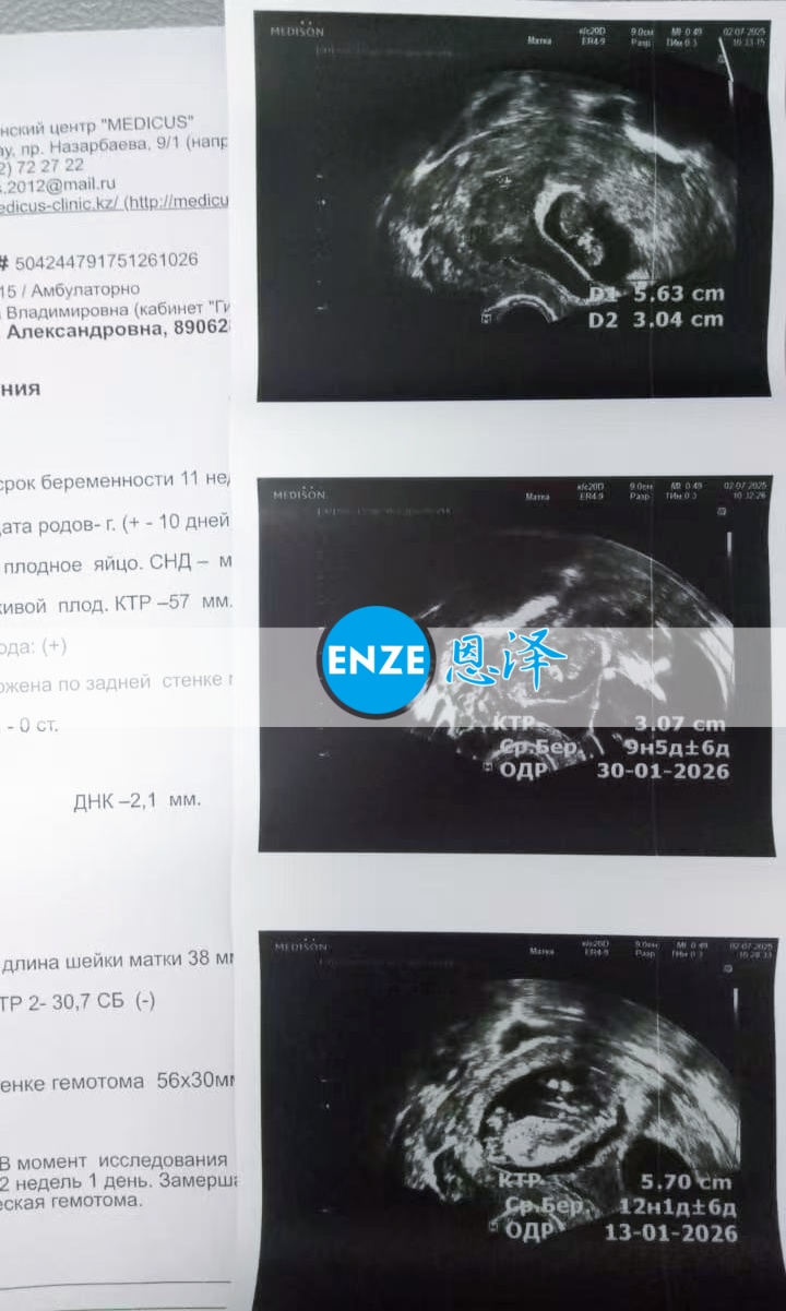 恩泽格鲁吉亚代孕代母11周检查顺利通过