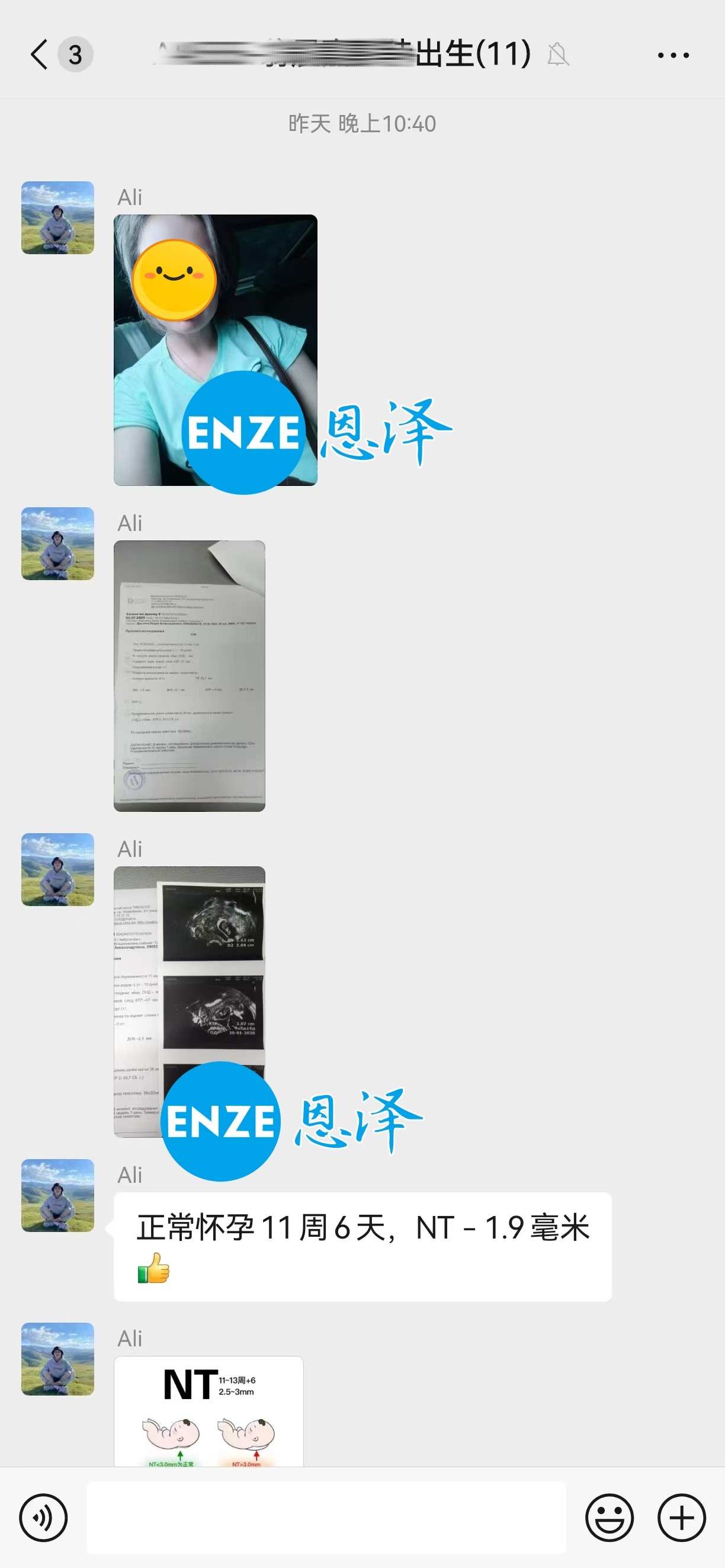 恩泽格鲁吉亚代孕代母11周检查顺利通过