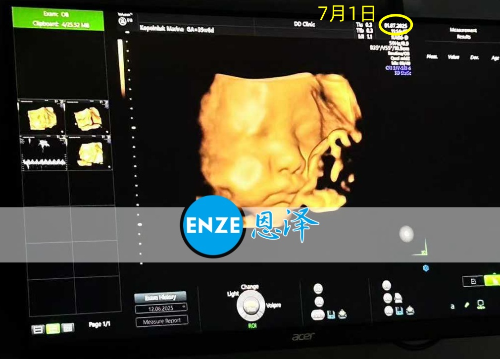 恩泽格鲁吉亚代孕代母35周检查顺利通过