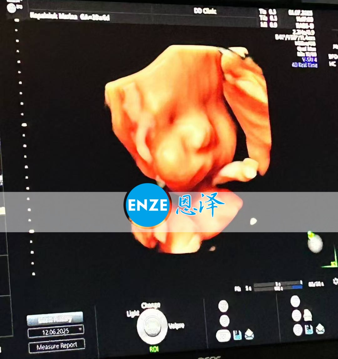 恩泽格鲁吉亚代孕代母35周检查顺利通过