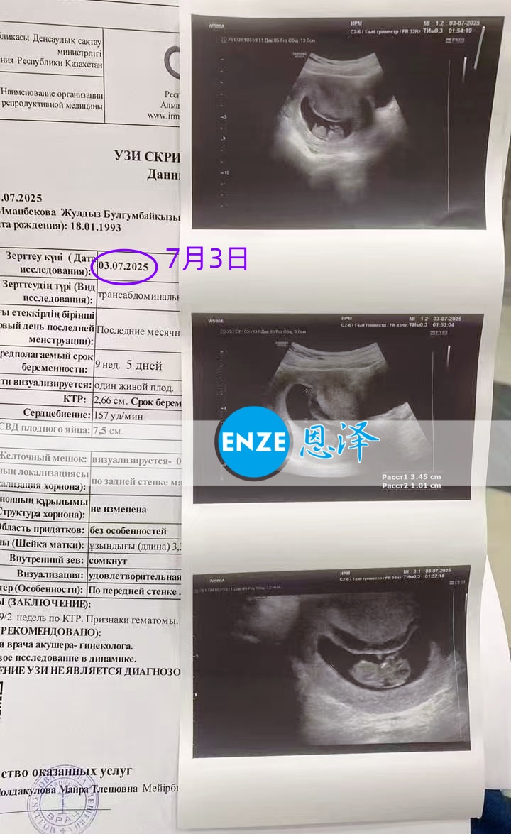 恩泽哈萨克斯坦代孕代母9周检查顺利通过