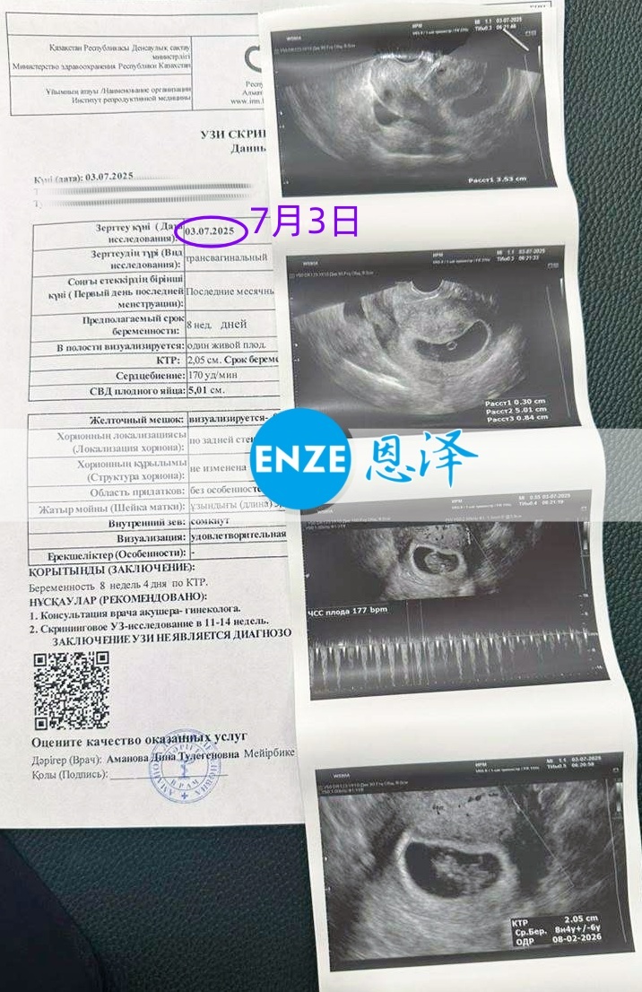 恩泽哈萨克斯坦代孕代母8周检查顺利通过